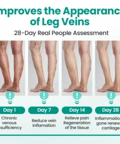Cvreoz® LegRenew Varicose Veins Patch