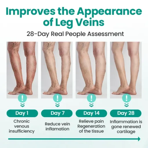 Cvreoz® LegRenew Varicose Veins Patch