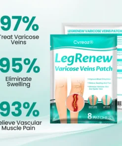 Cvreoz® LegRenew Varicose Veins Patch