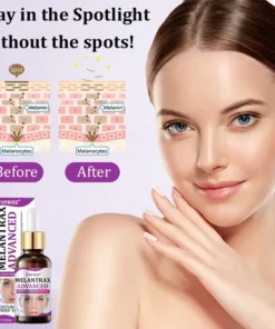 Cvreoz® MelantraX Advanced Anti-Hyperpigmentation Essence