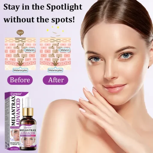 Cvreoz® MelantraX Advanced Anti-Hyperpigmentation Essence