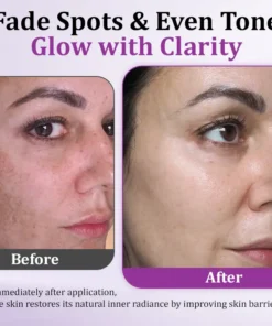 Cvreoz® MelantraX Advanced Anti-Hyperpigmentation Essence