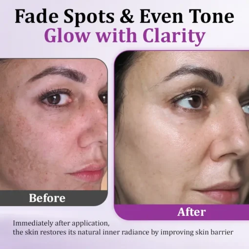 Cvreoz® MelantraX Advanced Anti-Hyperpigmentation Essence