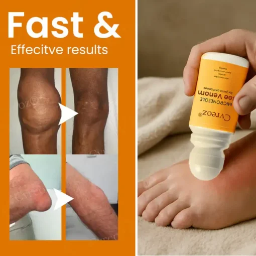 Cvreoz® Microneedle Bee Venom for Joints and Bones