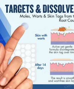 Cvreoz® Moles & Warts Removing Skin Tag Patch