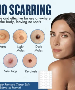 Cvreoz® Moles & Warts Removing Skin Tag Patch