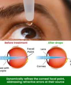 Cvreoz® Myopia Cure Drops
