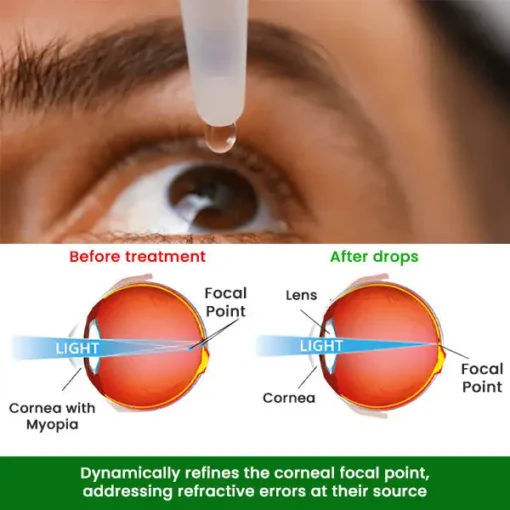 Cvreoz® Myopia Cure Drops