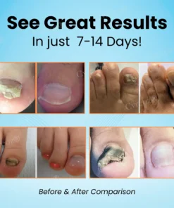 Cvreoz® Nail Strengthening Ointment