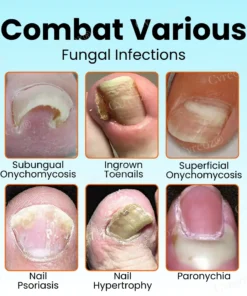 Cvreoz® Nail Strengthening Ointment