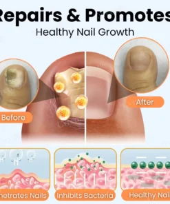 Cvreoz® Nail Strengthening Ointment