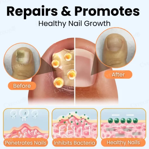 Cvreoz® Nail Strengthening Ointment