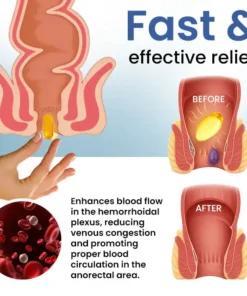 Cvreoz® Natural Hemorrhoid Capsules