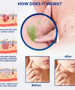Cvreoz® NatureErase Instant Mole & Spot Cream