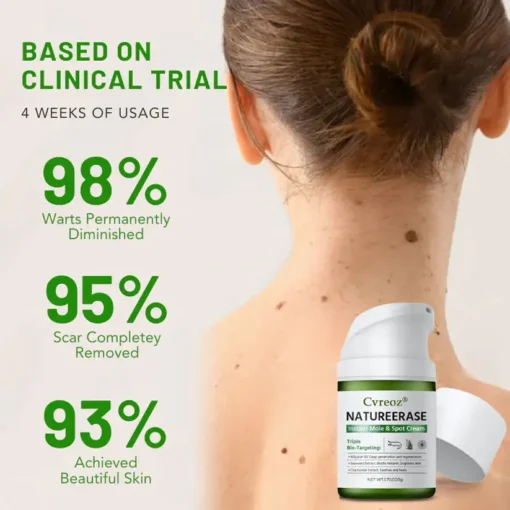 Cvreoz® NatureErase Instant Mole & Spot Cream