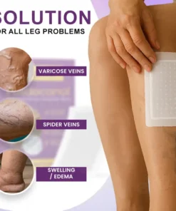 Cvreoz® Polidocanol Nano Patches for Varicose Veins