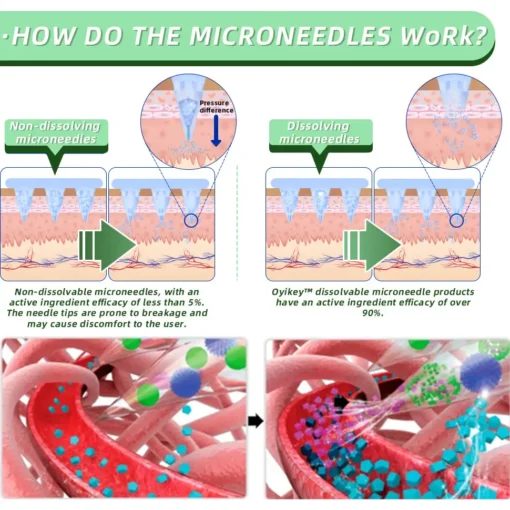 Cvreoz® SMGT-GLP-1 Nano Microneedle Patch