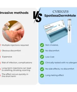 Cvreoz® SpotlessDerm Mole and Wart Laser Pen