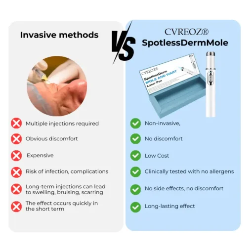 Cvreoz® SpotlessDerm Mole and Wart Laser Pen