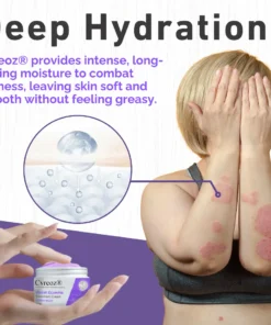 Cvreoz® Violet Eczema Treatment Cream