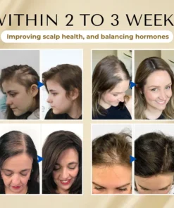 Cvreoz® VitaStrand Biotin Hair Growth Spray