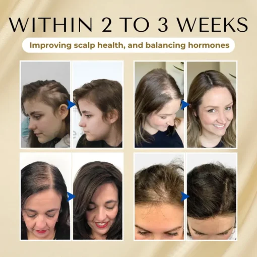 Cvreoz® VitaStrand Biotin Hair Growth Spray