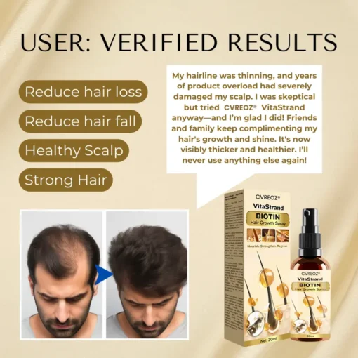 Cvreoz® VitaStrand Biotin Hair Growth Spray