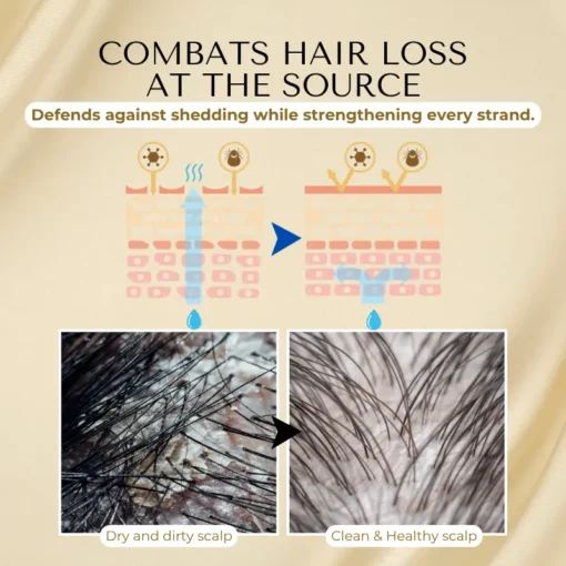 Cvreoz® VitaStrand Biotin Hair Growth Spray