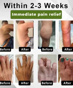 Cvreoz®SNAKE PEPTIDE 3X Instant Joint Pain Relief Gel