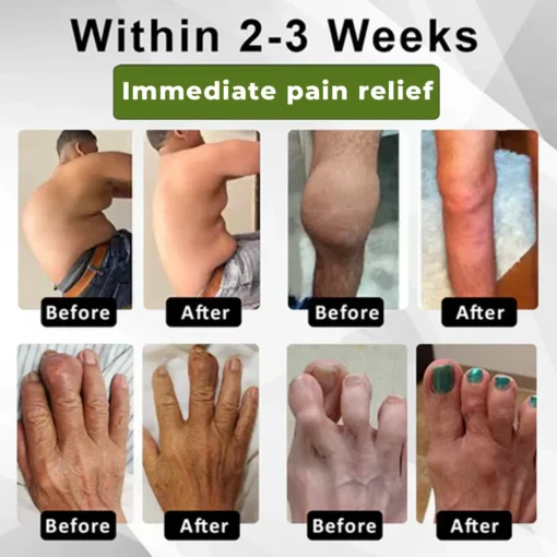 Cvreoz®SNAKE PEPTIDE 3X Instant Joint Pain Relief Gel