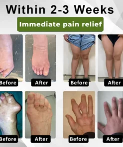 Cvreoz®SNAKE PEPTIDE 3X Instant Joint Pain Relief Gel