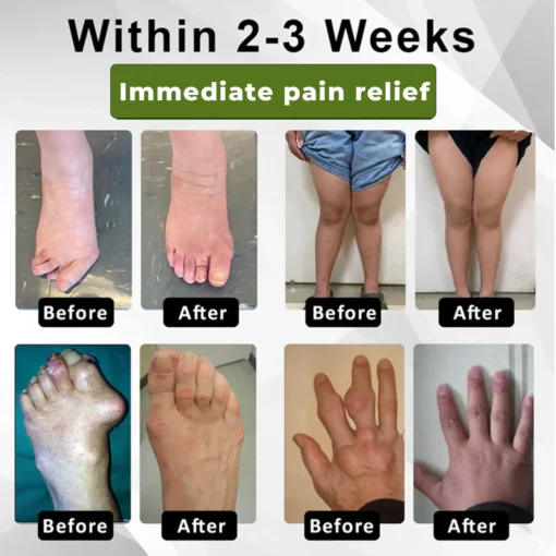 Cvreoz®SNAKE PEPTIDE 3X Instant Joint Pain Relief Gel