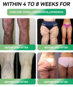 𝐂𝐯𝐫𝐞𝐨𝐳®𝐆𝐋𝐏-𝟏 𝐖𝐞𝐢𝐠𝐡𝐭 𝐋𝐨𝐬𝐬 𝐎𝐫𝐚𝐥 𝐒𝐨𝐥𝐮𝐭𝐢𝐨𝐧