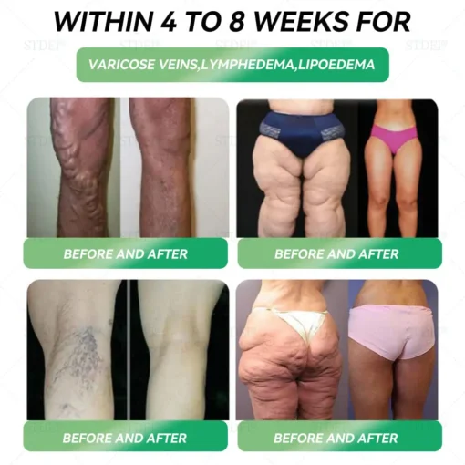 𝐂𝐯𝐫𝐞𝐨𝐳®𝐆𝐋𝐏-𝟏 𝐖𝐞𝐢𝐠𝐡𝐭 𝐋𝐨𝐬𝐬 𝐎𝐫𝐚𝐥 𝐒𝐨𝐥𝐮𝐭𝐢𝐨𝐧