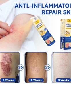 CVREOZ® Bee Poison Psoriasis Treatment Spray