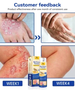 CVREOZ® Bee Poison Psoriasis Treatment Spray