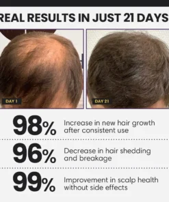 CVREOZ® FollicleBoost 5X Hair Growth Serum