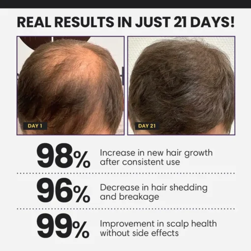 CVREOZ® FollicleBoost 5X Hair Growth Serum