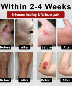 CVREOZ® GlucoseGuard Skin Rescue Cream