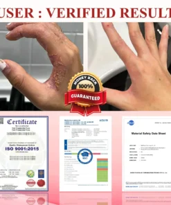 CVREOZ® GlucoseGuard Skin Rescue Cream
