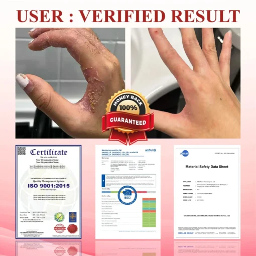 CVREOZ® GlucoseGuard Skin Rescue Cream
