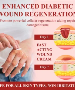 CVREOZ® GlucoseGuard Skin Rescue Cream