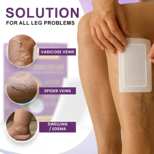 CVREOZ® Polidocanol Nano Varicose Vein Patch