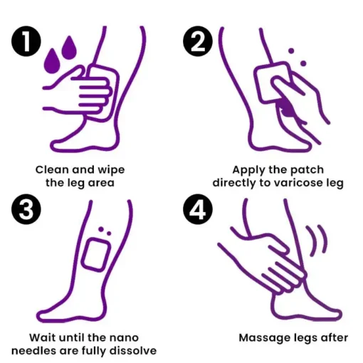 CVREOZ® Polidocanol Nano Varicose Vein Patch