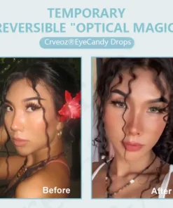Crveoz® IrisGlow Drops