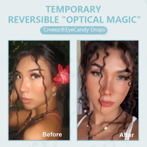 Crveoz® IrisGlow Drops
