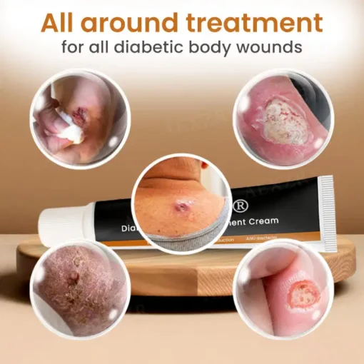 Cvreoz® Advanced Wound Healing Cream for Diabetic Skin