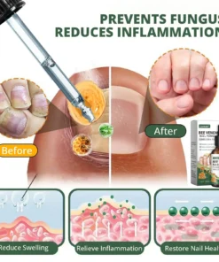 Cvreoz® Bee Venom Nail fungus care solution