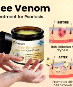Cvreoz® Bee Venom Psoriasis Care Cream