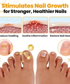 Cvreoz® BeeVenom Anti-Fungal Nail Renewal Oil
